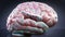 Bulimia nervosa and a human brain