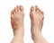 Bunion - hallux valgus on white background and clipping path