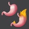 Burning stomach. Realistic human organ of internal digestion system on fire. Vector illustration of heartburn digestive, gastric