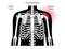 Bursitis inflammation concept