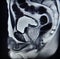 Ca prostate mri exam diagnostic