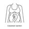 Caesarean section views icon line in vector, illustration of a pregnant woman.