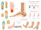 Calcaneal spur. Plantar fasciitis set. Medical desease infographics collection