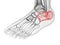 The calcaneus bone