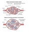 Capillary bed lymphoedema