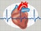 Cardiac arrhythmia