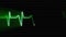 Cardiac impulse sequence on medical monitor