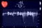 Cardiac ultrasound images and small heart . Doppler echo