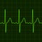 Cardiogram on digital device monitor. Electrocardiogram. Graphic representation of heart work . Health and medicine.