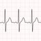 Cardiogram. Electrocardiogram. Graphic representation of heart work . Health and medicine.