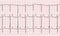 Cardiogram. Fragment of research result by CU