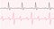 Cardiogram on a graph paper. Heartbeat line. Vector illustration