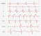 Cardiogram, heart red rhythm on monitor screen