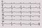 Cardiogram. Heartbeat. The graph on graph paper.