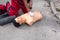 Cardiopulmonary resuscitation - CPR