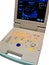 cardiovascular monitor, lungs and pleura control panel, corona virus covid10 screening, digital diagnostic