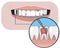 A caries and pulpitis with a smile as a treatment concept in a dental or orthodontic clinic, a vector stock illustration with