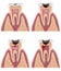 Caries stages