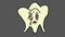 Caries tooth, illustration