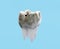 Carious molar tooth on blue background