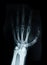 Carpal bones Human X Ray.