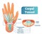 Carpal tunnel vector illustration scheme. Medical labeled diagram closeup with transverse carpal ligament and median nerve.