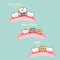 Cartoon dental implant