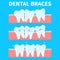 Cartoon teeth vector illustration, before and after brace correction. Concept of ortodontic treatment. Stages of dental