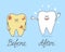 Cartoon tooth before and after cleaning. Comparison of Ill and healthy teeth