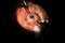 Cataract ophthalmologic surgery