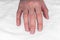 Caucasian female hand with natural broken unpolished nails, overgrown cuticles on a textile white background