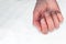 Caucasian female hand with natural unpolished nails, overgrown with cuticles on a textile white background