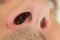 Caucasian male unkempt nose hair follicles macro close up shot. Close up shot, unrecognizable