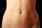 Caucasian woman\'s abdomen marked with lines