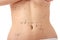 Caucasian woman\'s abdomen marked with lines