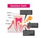 Cause and mechanism of Sensitive teeth illustration