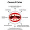 Causes of caries. Smell from the mouth. Halitosis. The structure of the teeth and oral cavity. Diseases of the teeth