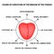 Causes of curvature of the midline of the tongue. Definition of a disease according to human tongue. Diagnostics by