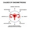 Causes of endometriosis. Adenomyosis. The structure of the pelvic organs with endometriosis. Infographics. Vector