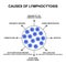 Causes of lymphocytosis. The increase in lymphocytes in the blood. Cell killers. Immunity Helper Cells. Infographics