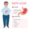 Causes and symptoms of peptic ulcer stomach disease