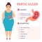 Causes and symptoms of peptic ulcer stomach disease