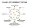 Causes of thrombocytopenia. Reducing platelets in the blood. Infographics. Vector illustration on isolated background.