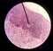 Cells in reproductive female cytology and histology concept