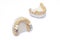 Ceramic-metal bridges on the models of the upper and lower jaws. prosthetics of damaged and missing teeth