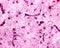 Cerebral cortex. Protoplasmic astrocytes