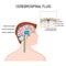 Cerebrospinal fluid CSF is a clear fluid in the brain and spinal cord