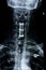 Cervical spine/front