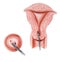 Cervix & Endocervix - Biopsy