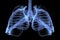 Chest x-ray image of dextrocardia and situs inversus patient that demonstrated heart,lungs,ribs,bones and muscles look like